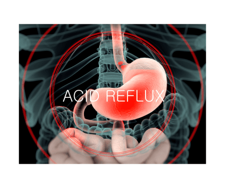 The #1 Tool Busy Working Women Can Use To Keep Acid Reflux And Bloating From Slowing Them Down. &Raquo; Acid Reflux