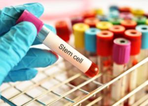 The Dangers Of Stem Cell Clinics