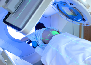 Important Things To Know About Radiation Treatment