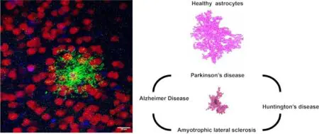 New Research Supports Brain Cell Transplantation As A Treatment For Some Neurological Disorders &Raquo; File 20240912 18 54W8Az