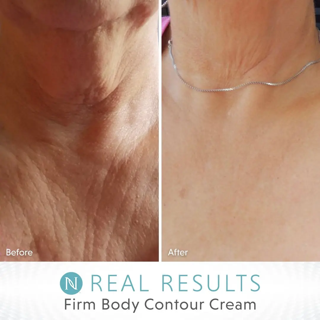 Revolutionize Your Body Contouring Journey: The Unmatched Benefits Of Neora’s Firm Body Contouring Cream And Its 5 Active Ingredients &Raquo; 2023 04 25 12.00.41