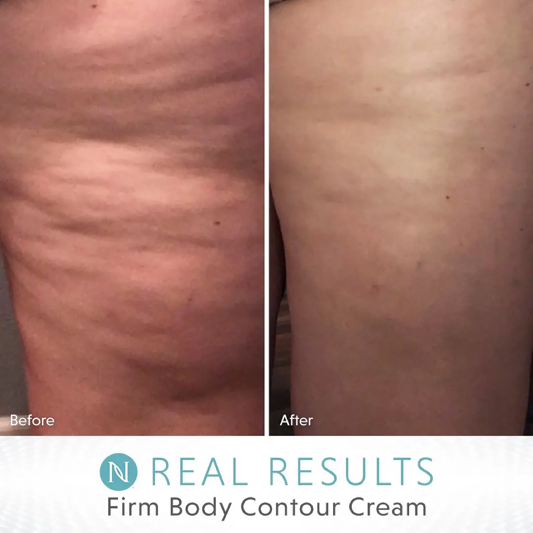 Revolutionize Your Body Contouring Journey: The Unmatched Benefits Of Neora’s Firm Body Contouring Cream And Its 5 Active Ingredients &Raquo; 2023 10 27 11.12.34
