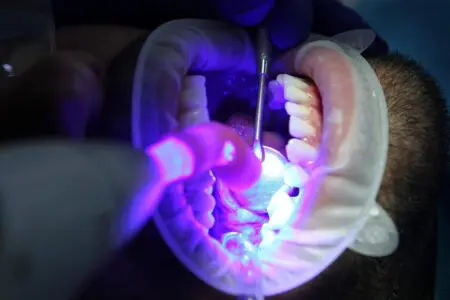 Embrace Time-Saving Tech For Your Dental Practice And Business Growth  &Raquo; Open Mouth Dentist 7397734 1280 1024X682 1