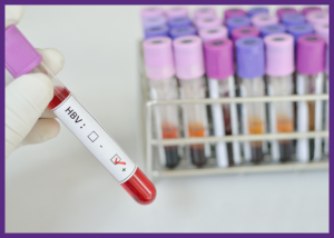 Managing Hepatitis B: Tips To Stay Healthy &Raquo; Up Close Photo Of A Gloved Hand Holding A Tube Of Blood Showing A Positive Hepatitis B Sample With A Tray Of Tubes In The Background Canva Border Added 1 300X214 1