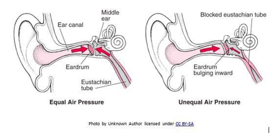 Adult Ears During Cold &Amp; Flu Season &Raquo; Word Image 1