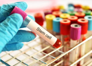 The Dangers Of Stem Cell Clinics &Raquo; Photo Of A Hand Holding A Vial Of Blood With A Stem Cell Label With Other Vials In The Background Canva E1672664751161 300X215 1