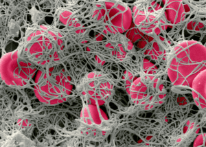 Reduce Your Risk Of Deep Vein Thrombosis &Raquo; Photo Of Red Blood Cells In A Fibrin Mesh Forming A Blood Clot Canva 1 300X214 1